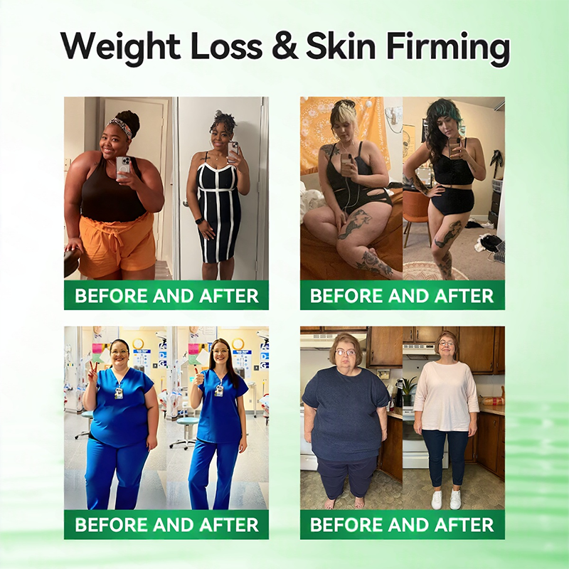 Official Store | ⏰ 𝐒𝐥𝐢𝐦𝐨𝐥𝐲™ 12-IN-1 Moringa * Berberine * NAD+ Advanced Nano Microneedle Patch (Once Daily, visible changes in 7 days) For Obesity, Loose Skin, Diabetes, Sleep Apnea, And Joint Issues 🎀